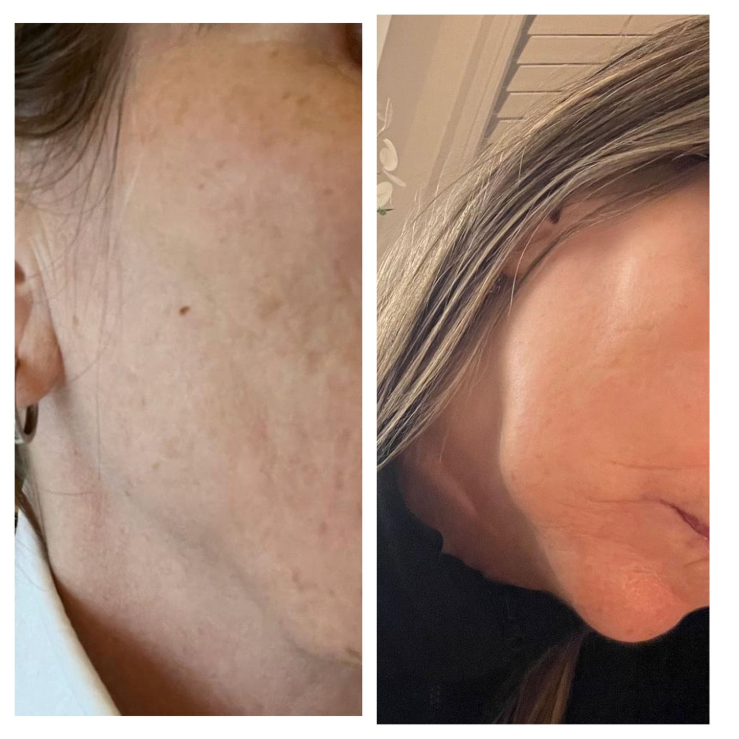 Radiance Facial Oil