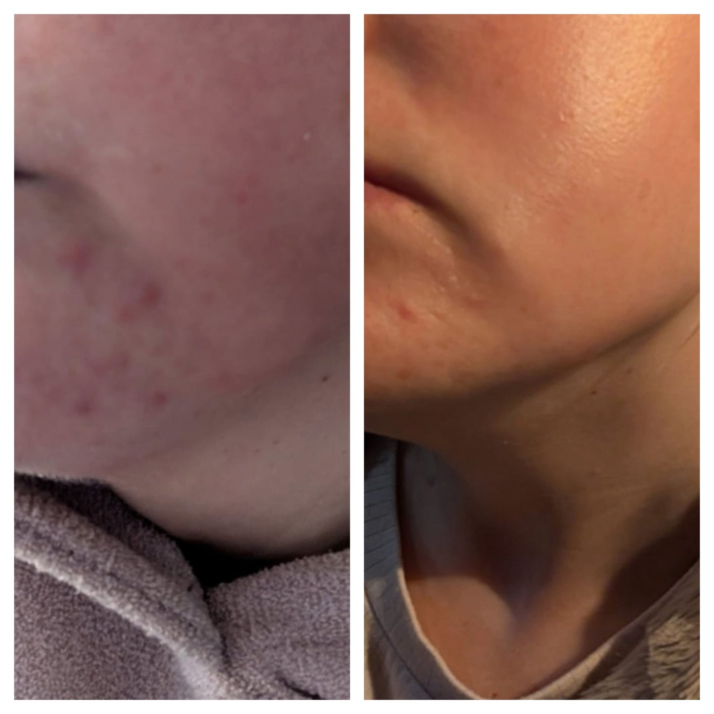 Radiance Facial Oil
